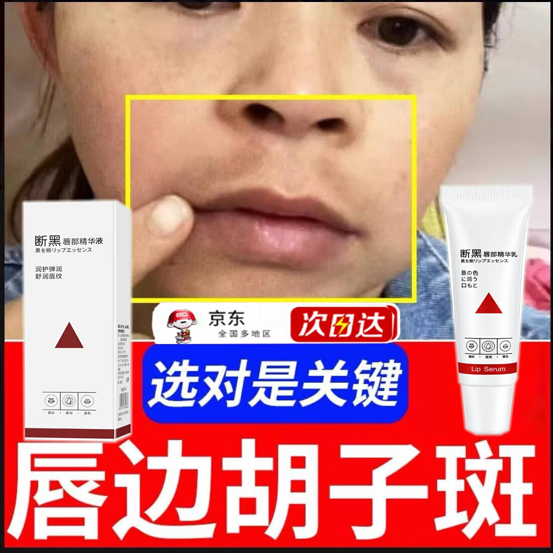 嘴巴周围一圈黑是怎么回事