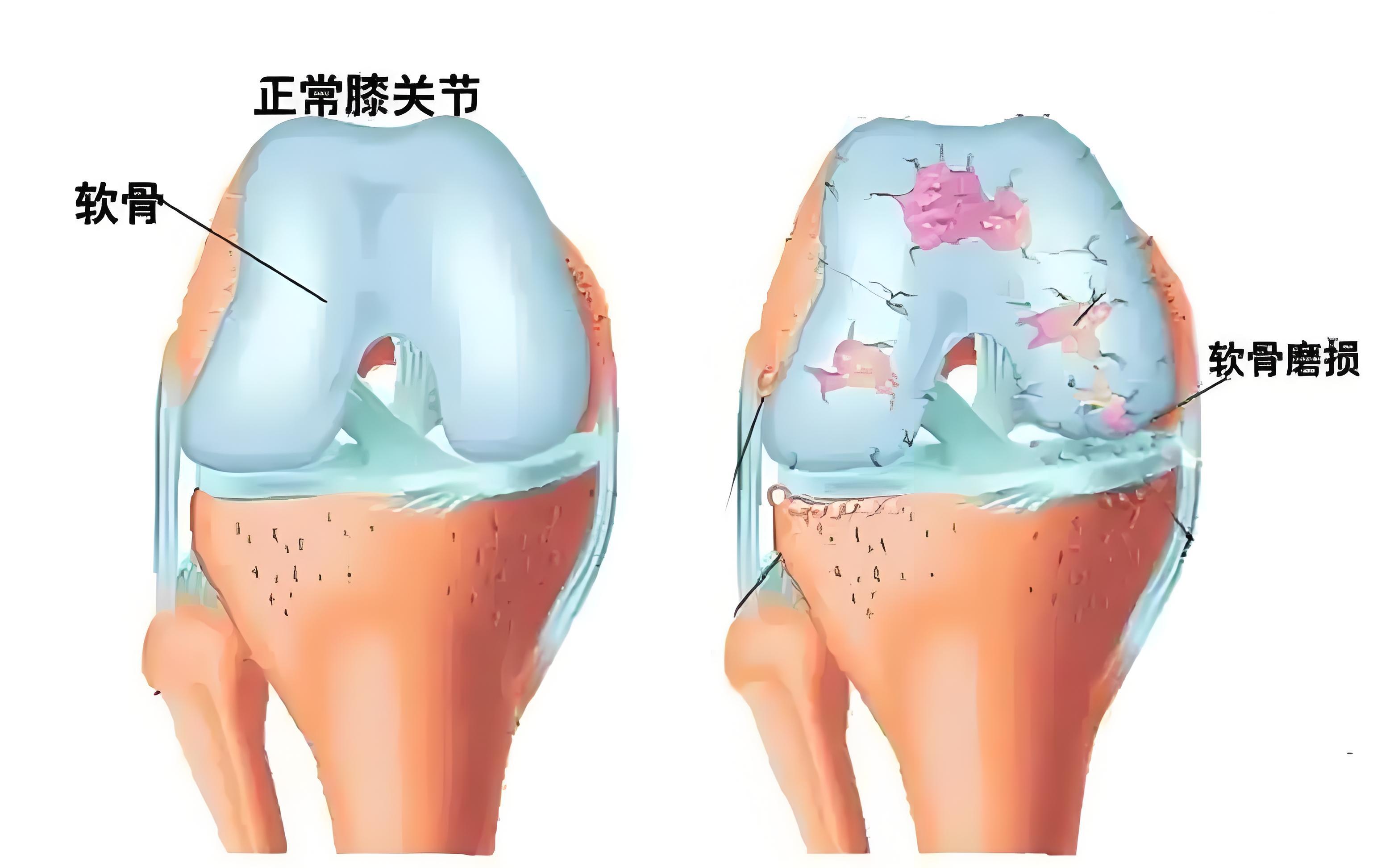 枝初蓝 第2页