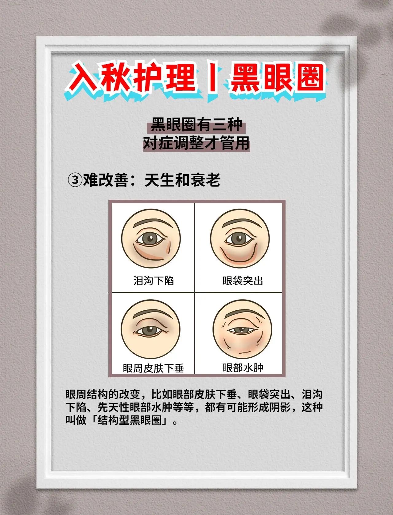 黑眼圈是怎么回事