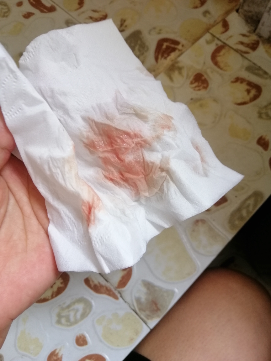 怀孕40天出血怎么办