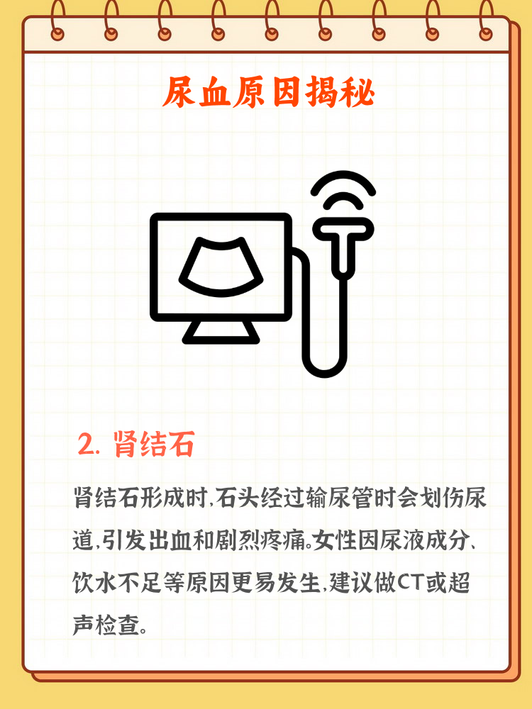 女人小便有血的原因都有哪些