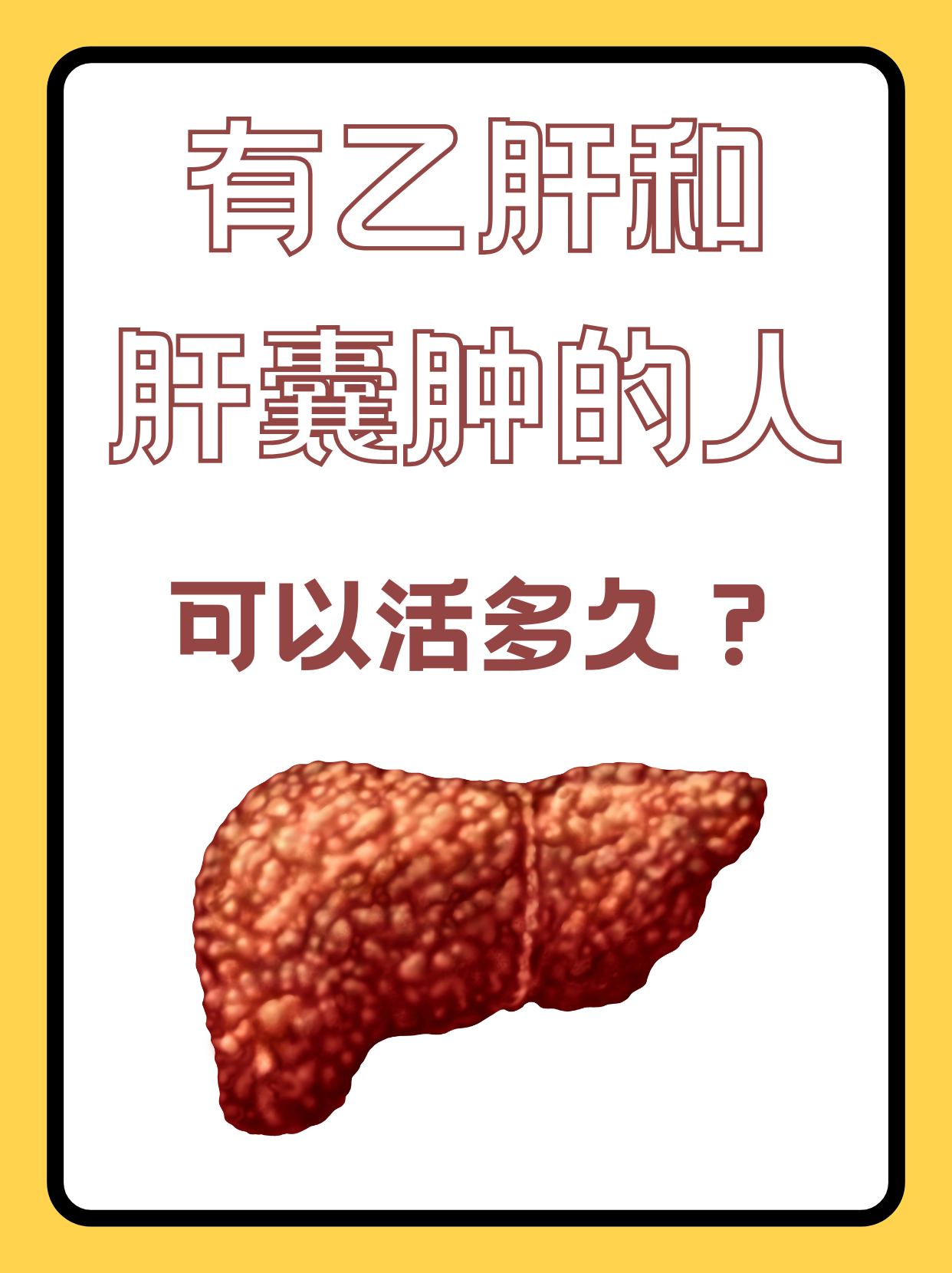 肝囊肿的病因是什么?