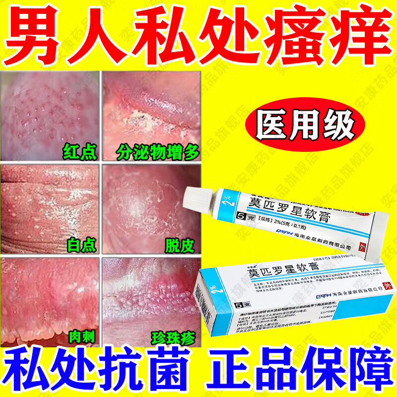 包皮炎用什么药膏