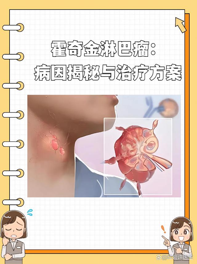 霍奇金淋巴瘤患者还可以活多久