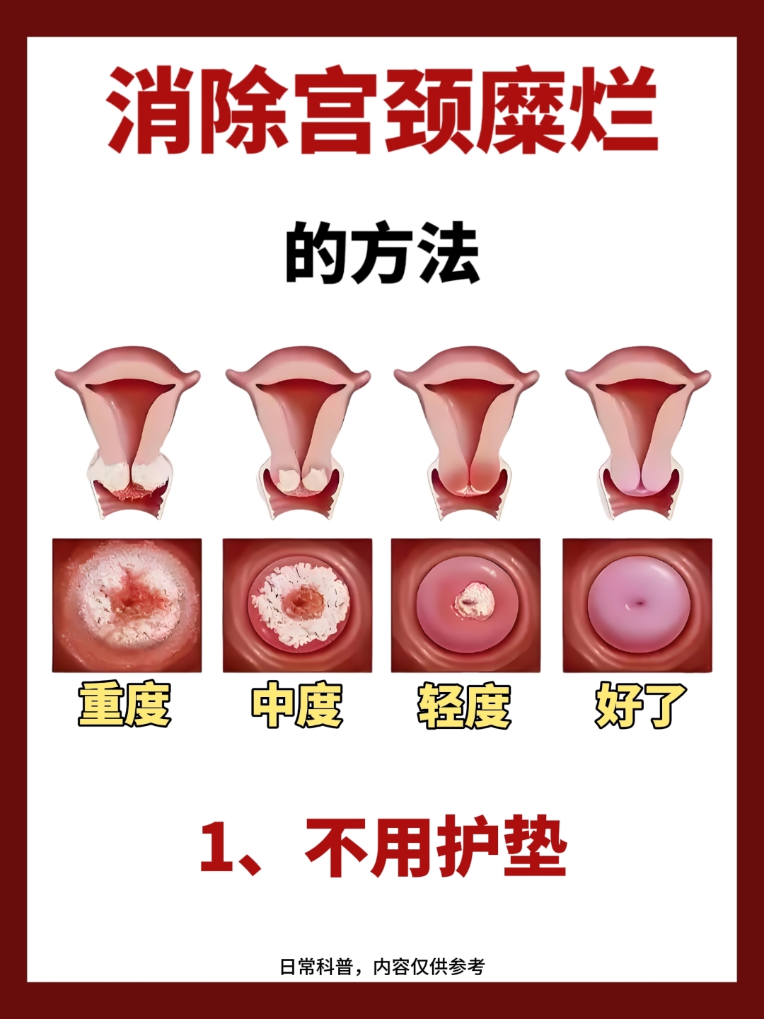 宫颈肥大需要治疗吗