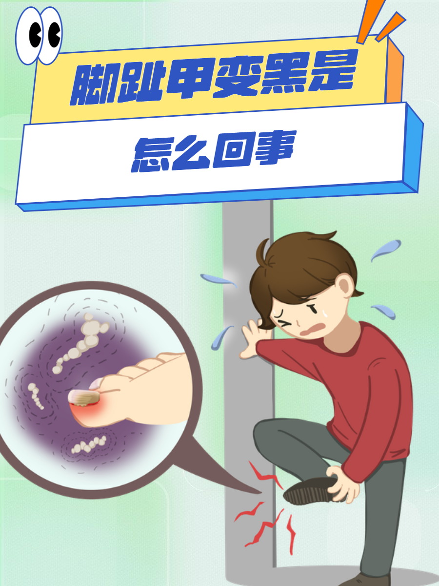 脚趾甲发黑是怎么回事