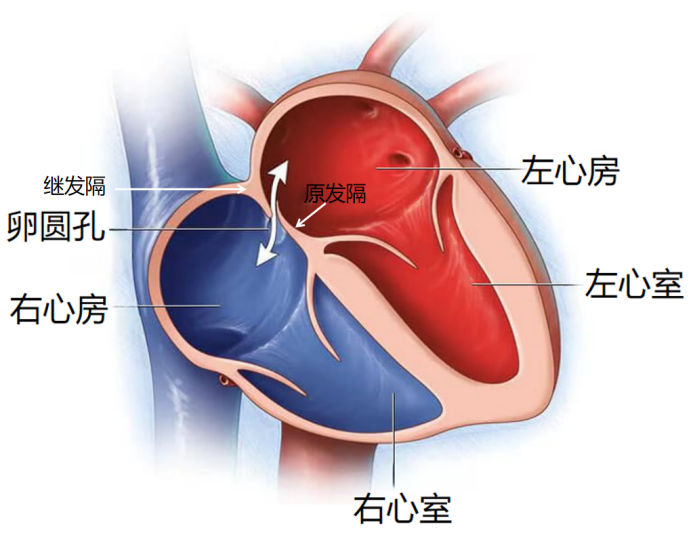 卵圆孔未闭3mm严重吗