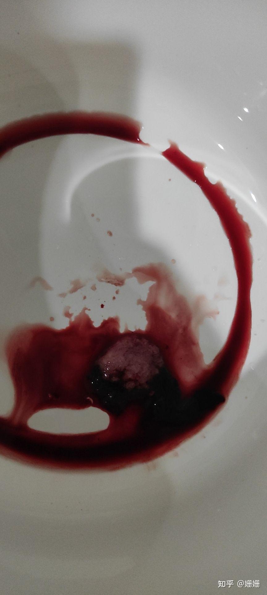 药流第一天第二天会出血吗?