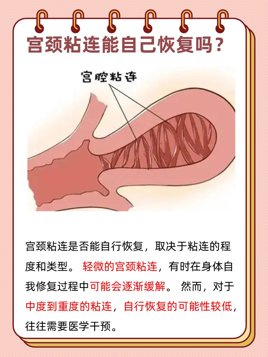 宫腔粘连怎么办..