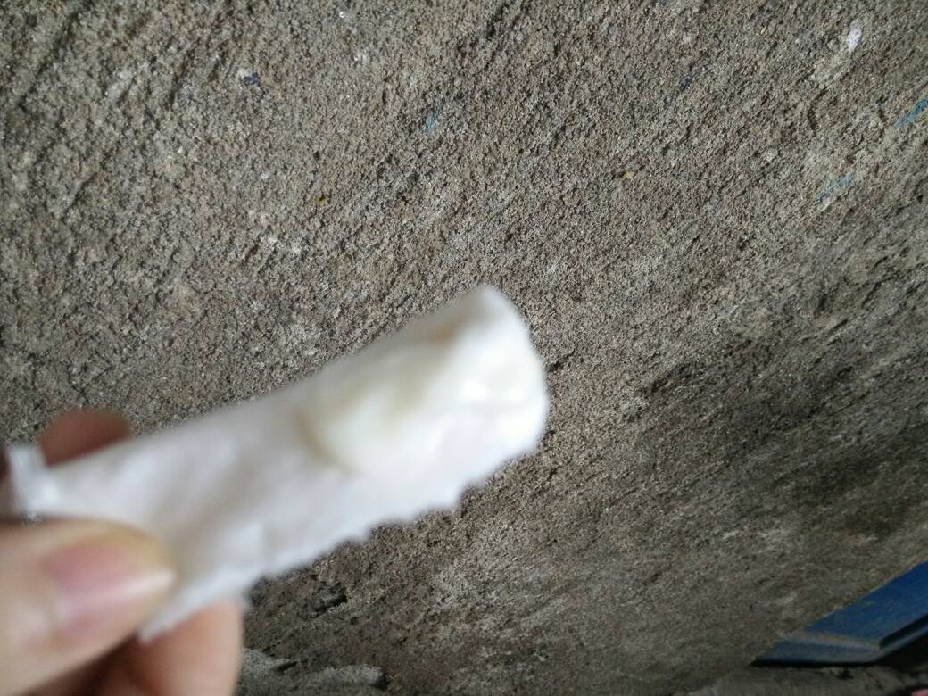 白带很浓稠,像是浆糊一样