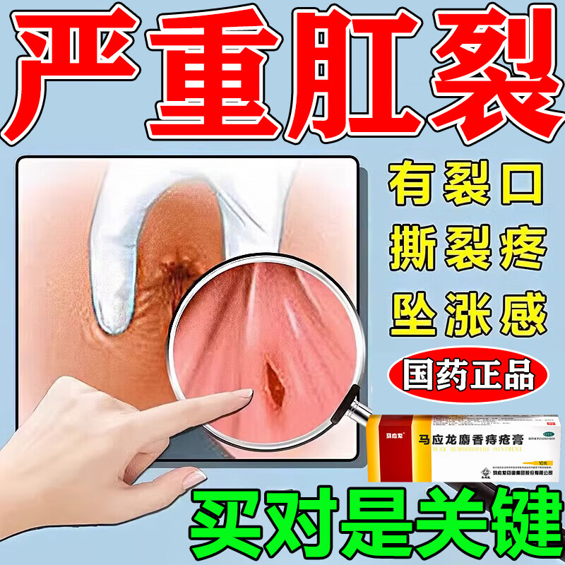 肛裂用什么药膏好的快?