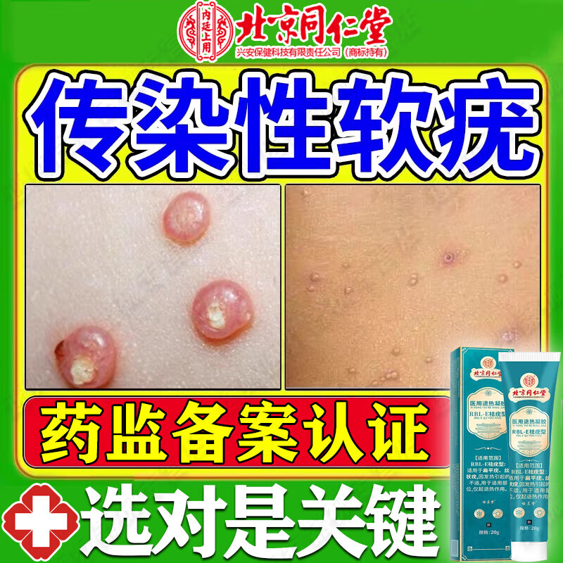 病毒性软疣的最好治疗方法