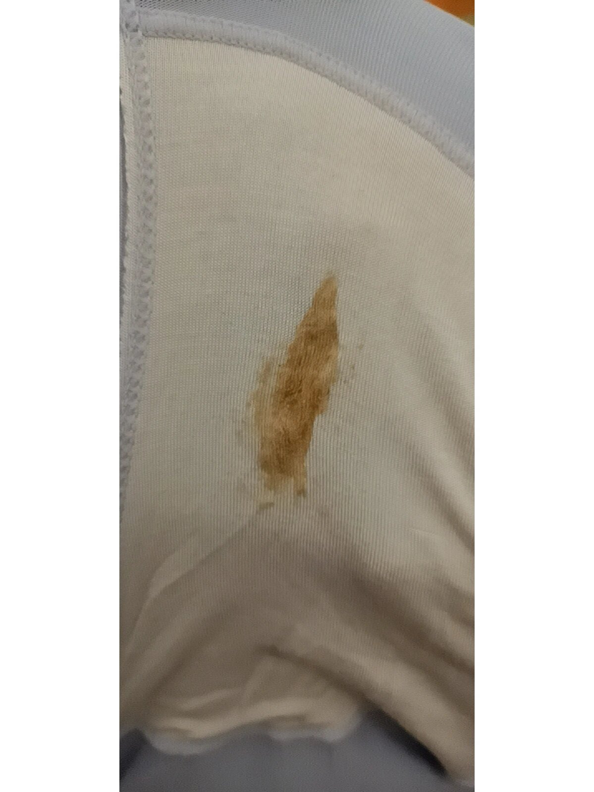 怀孕白带有点褐色怎么回事