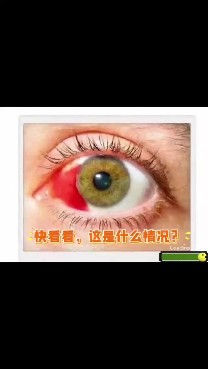 眼球出血怎么回事?