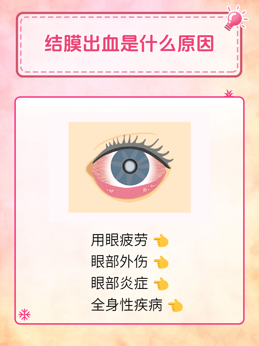 眼球出血怎么回事?