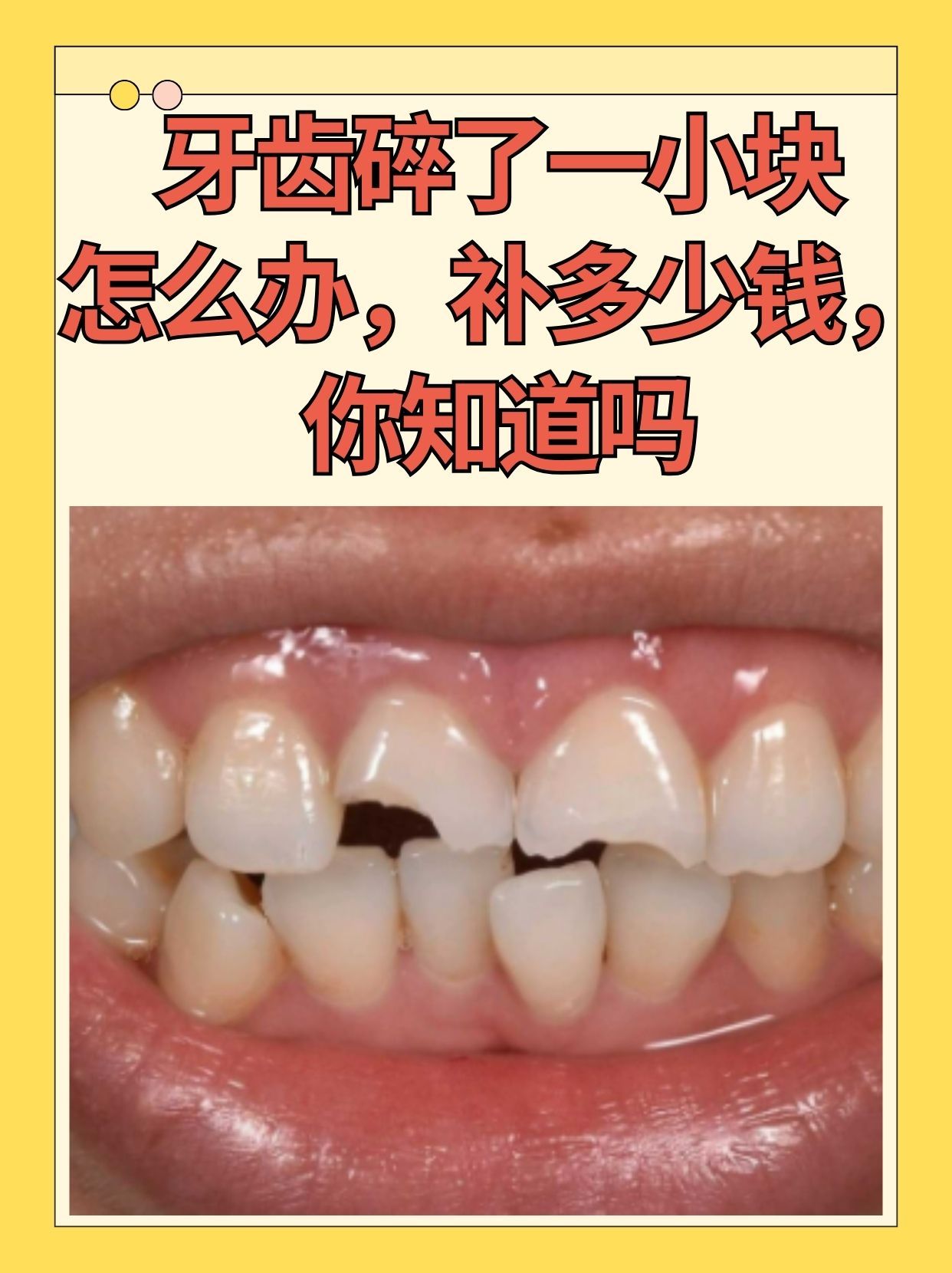 梦见自己牙碎了是什么原因