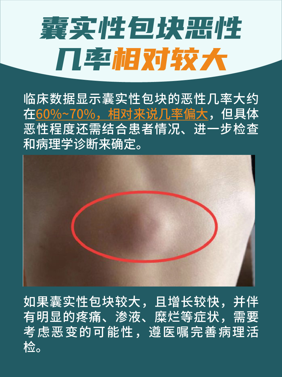 囊肿是什么病?严重吗????