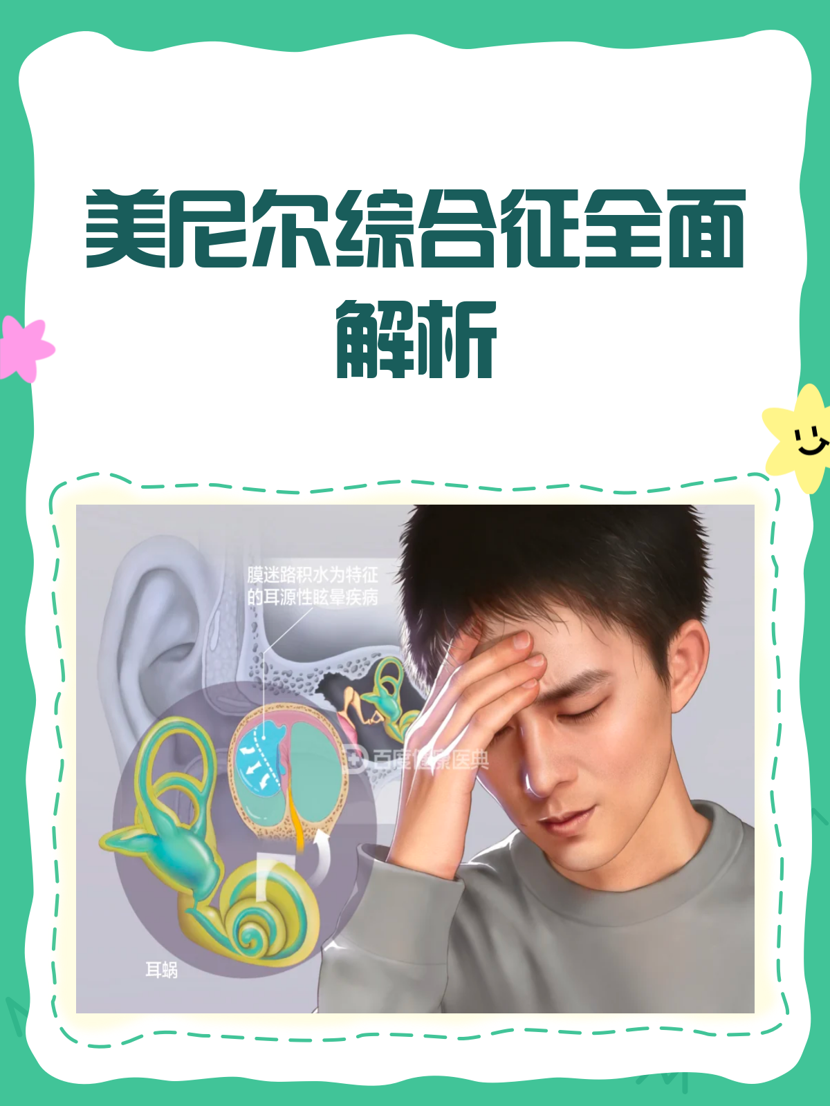 美尼尔综合征怎么治疗最好