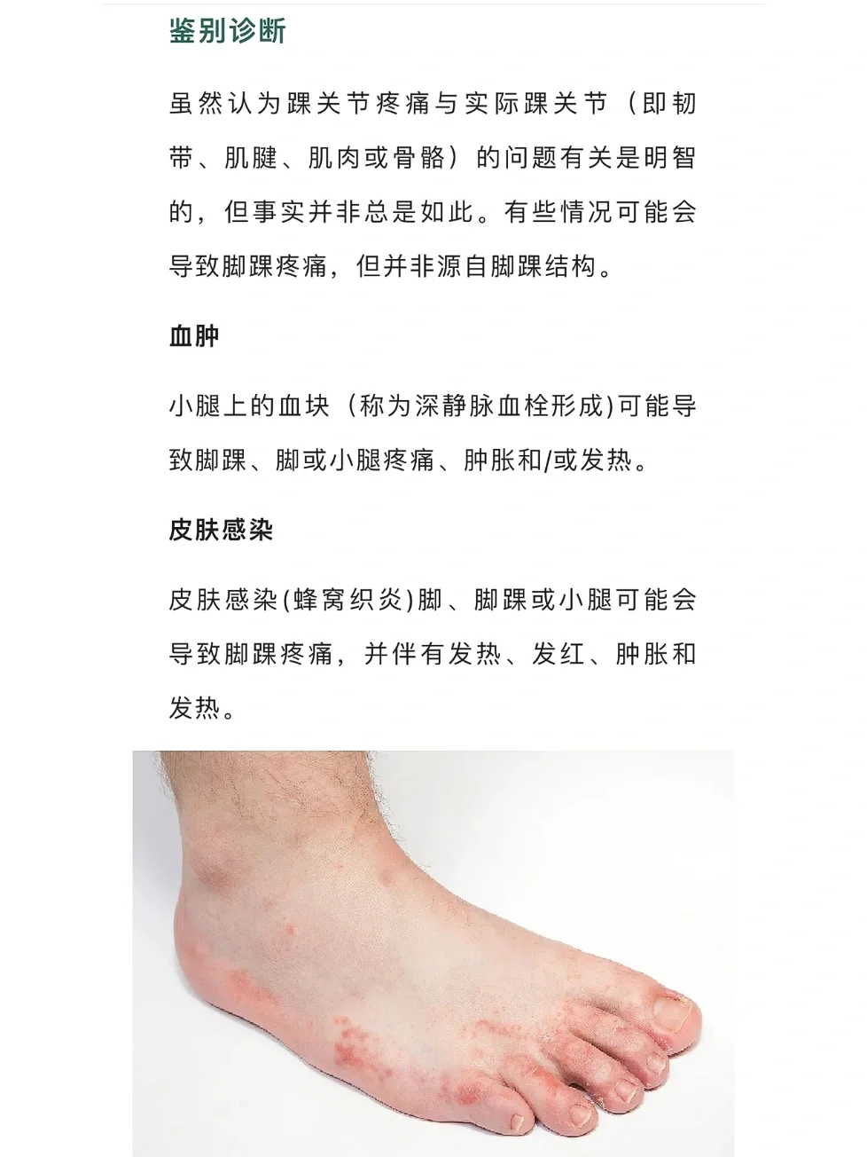 脚脖子疼是怎么回事?