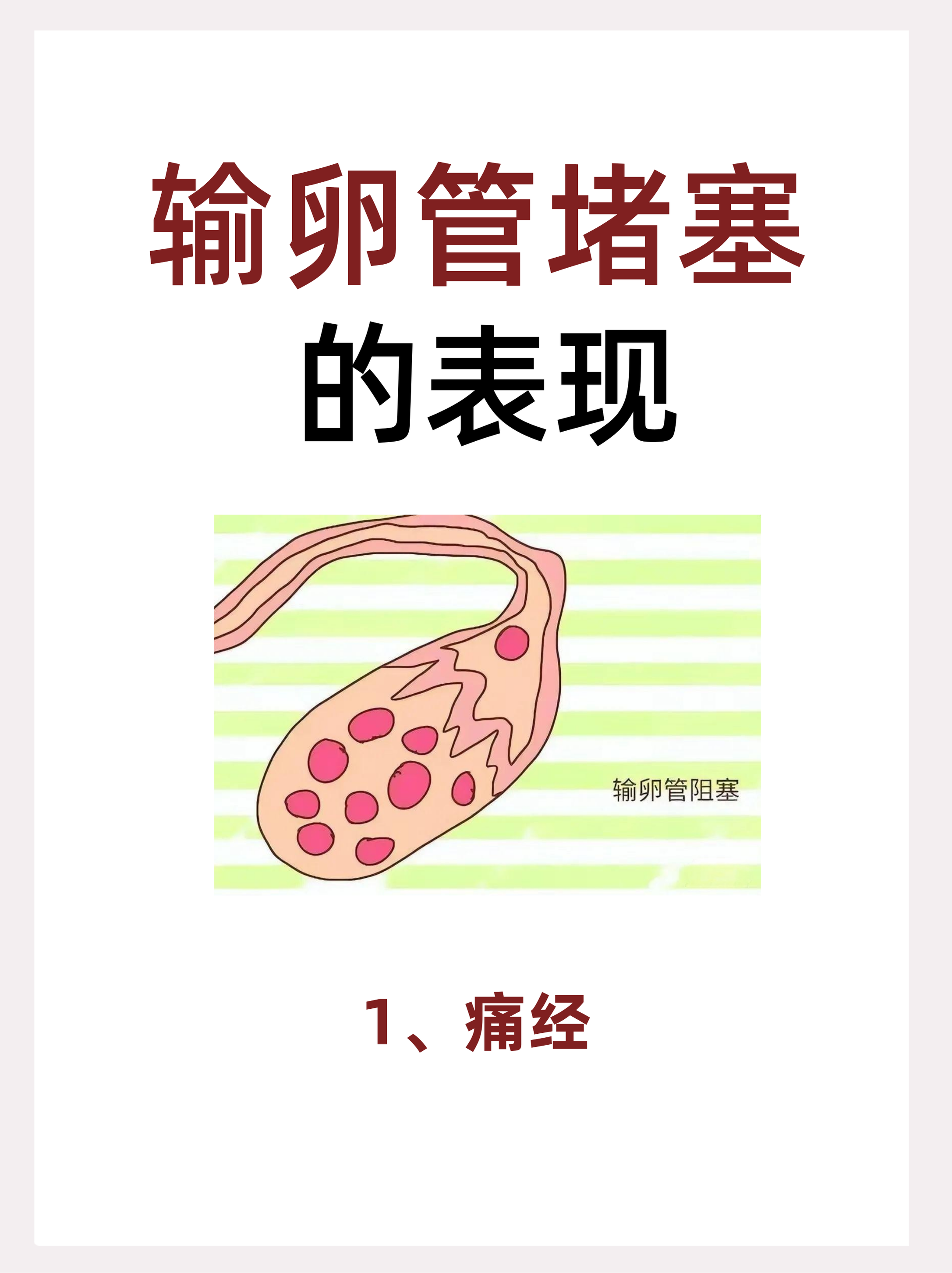 输卵管堵塞该怎么治疗?