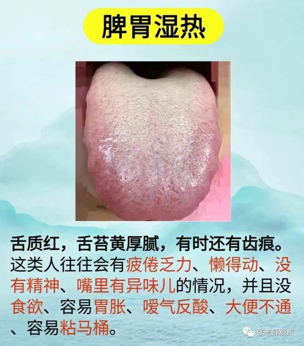 什么是肝胆湿热