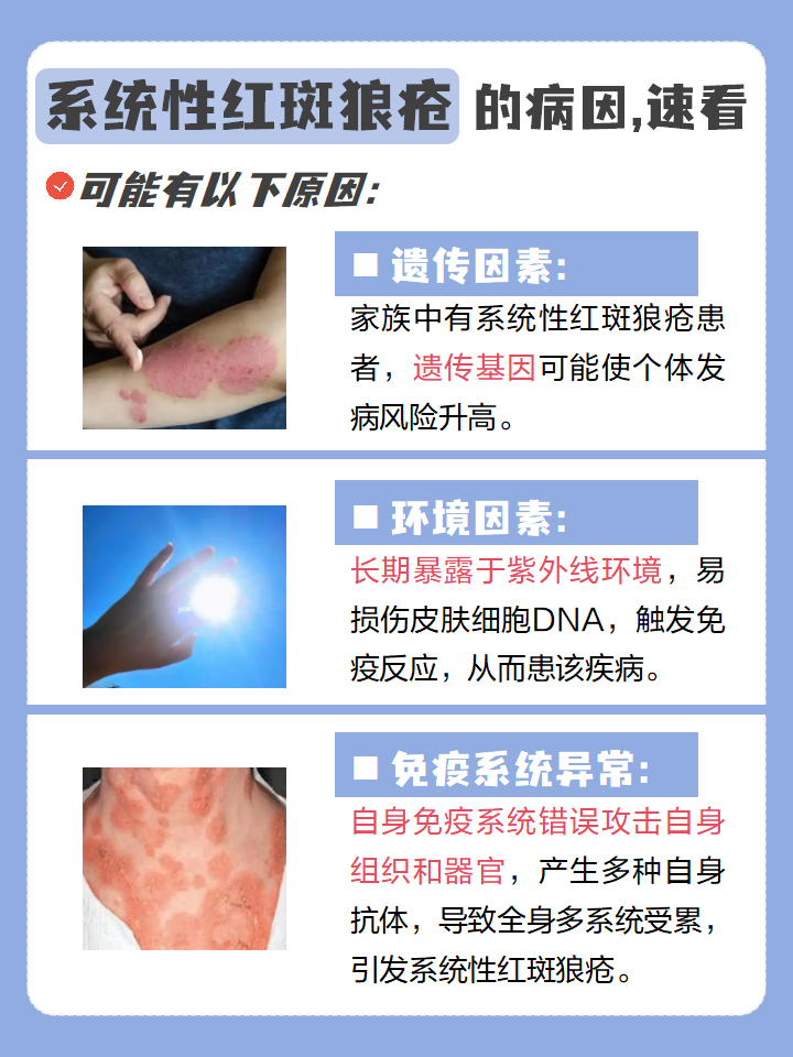 什么是系统性红斑性狼疮