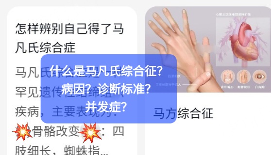 席汉氏综合征临床表现