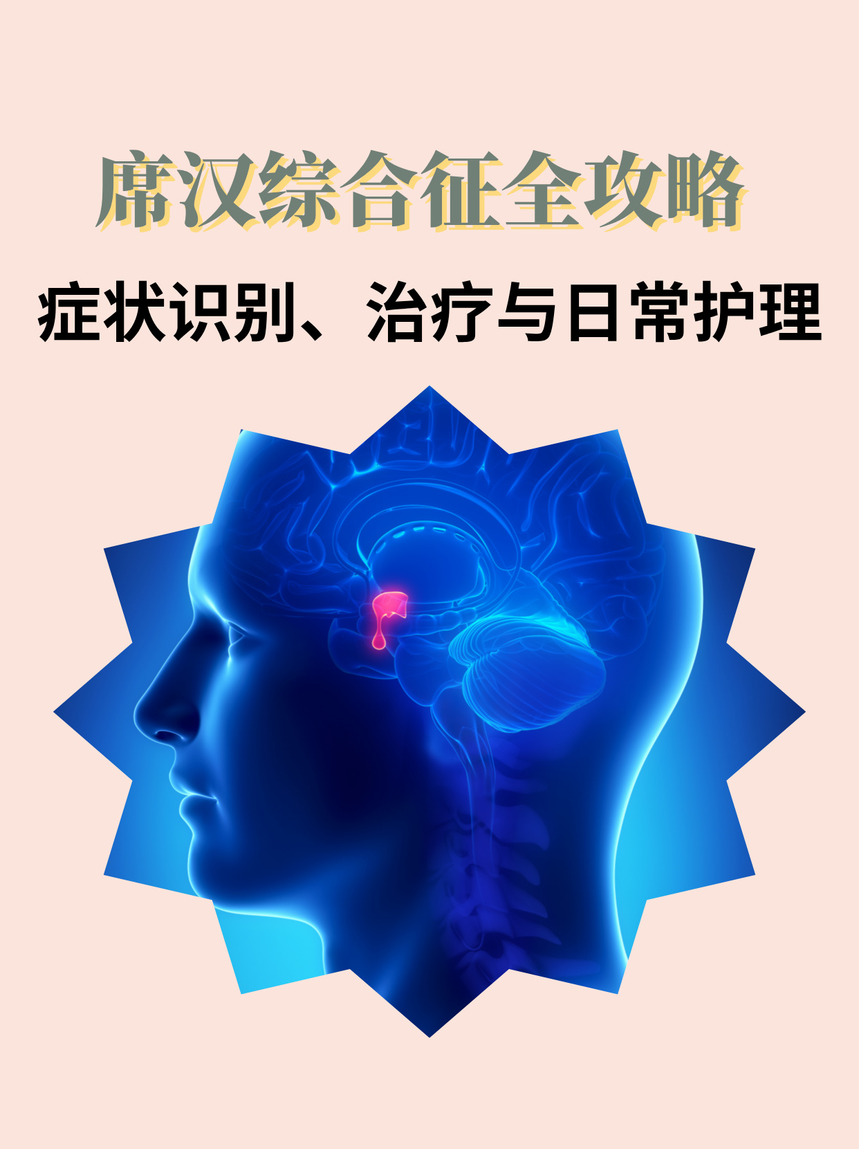 席汉氏综合征临床表现