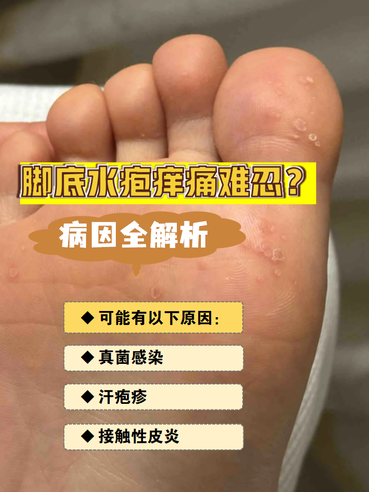 脚上长小水泡是怎么回事