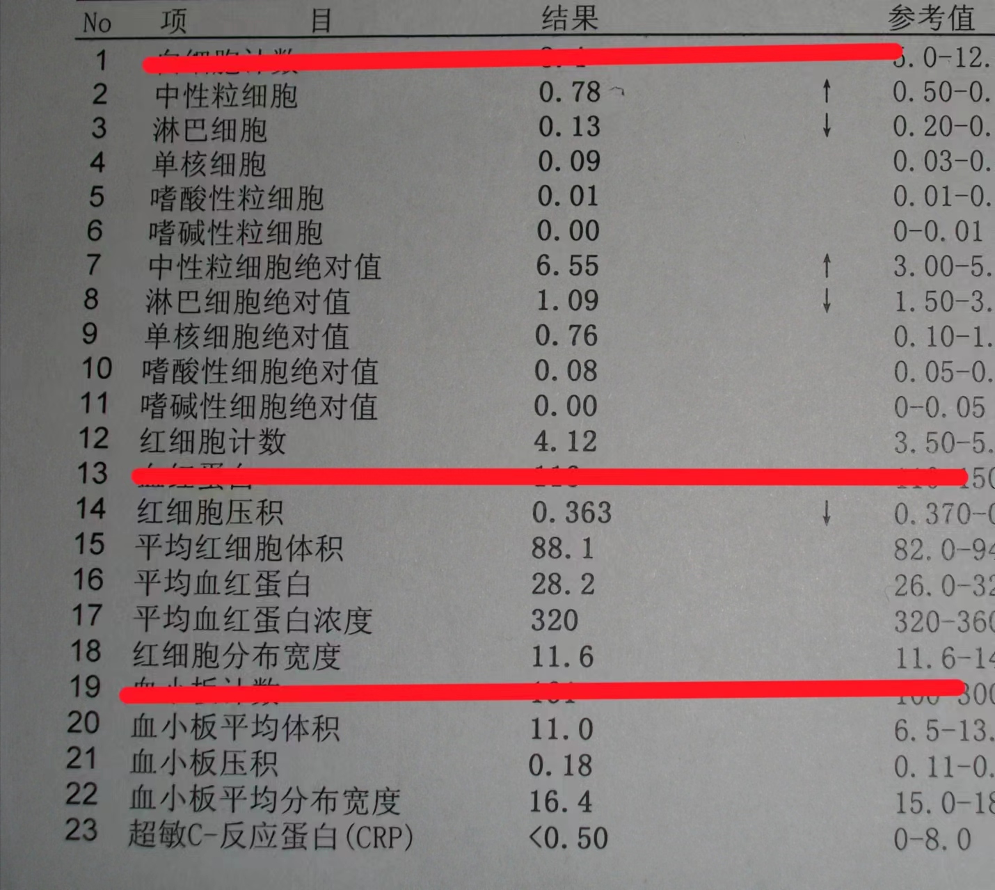 乙肝小三阳是哪几项指标