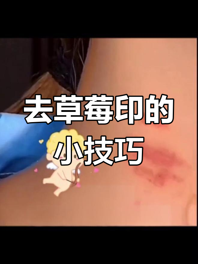 请问吻痕怎么快速消除