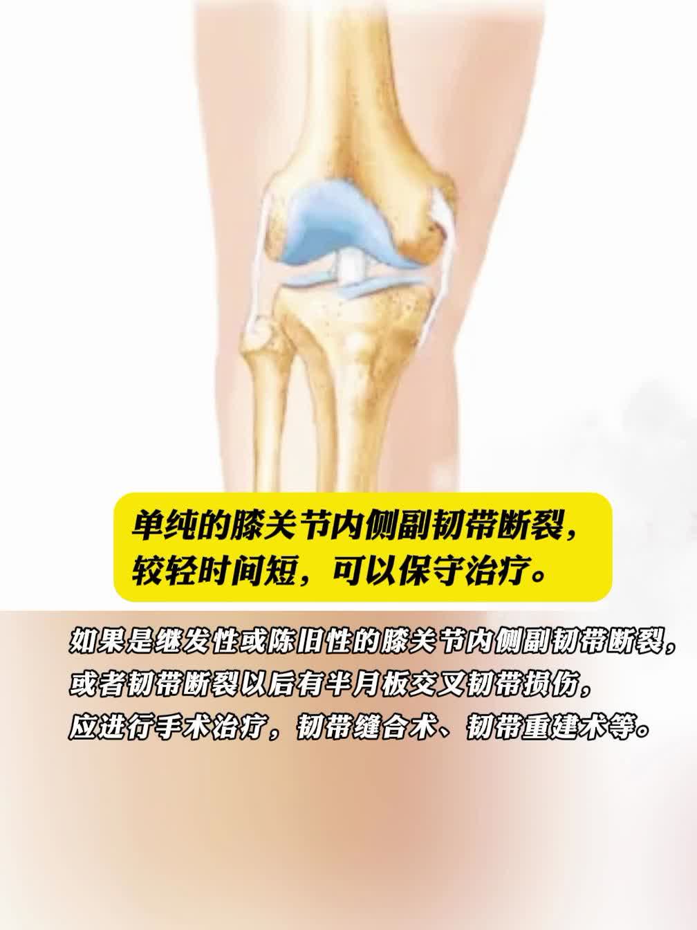 韧带损伤能自愈吗