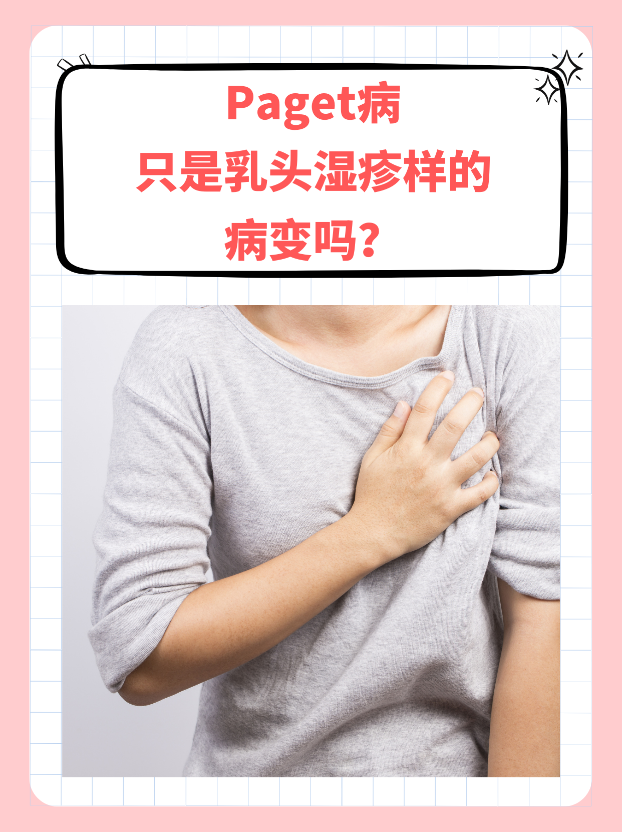 乳房湿疹长什么样子