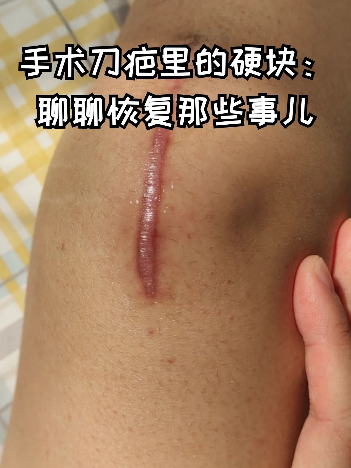 出运升 第2页
