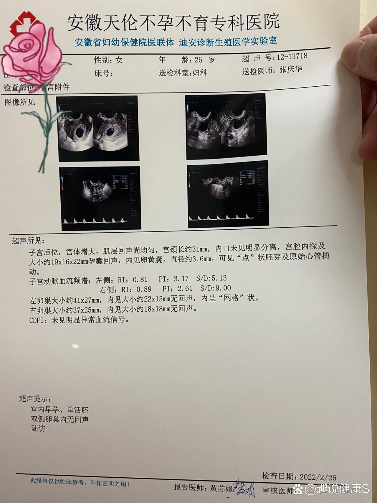 胎心146是男孩吗