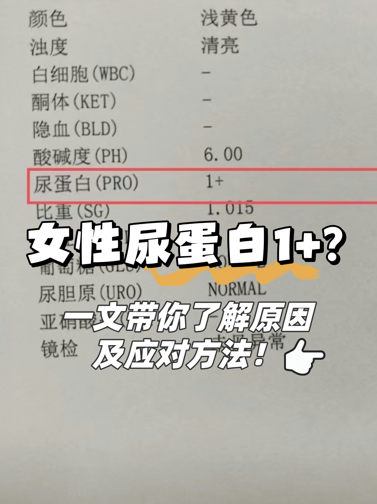 什么情况会导致尿蛋白偏高