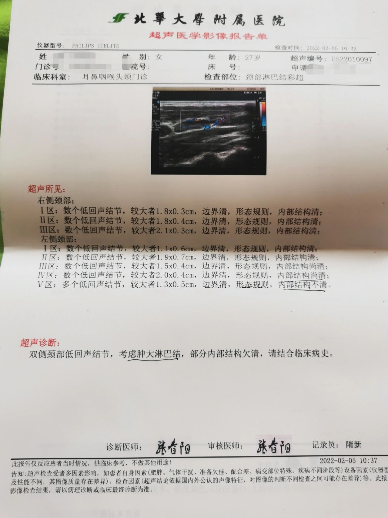 良性淋巴结的彩超特征是什么