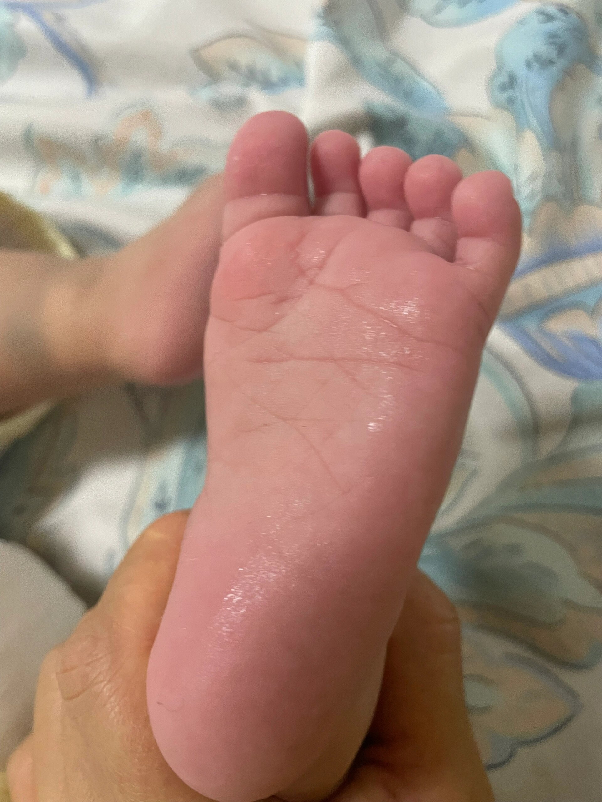 婴儿手心出汗