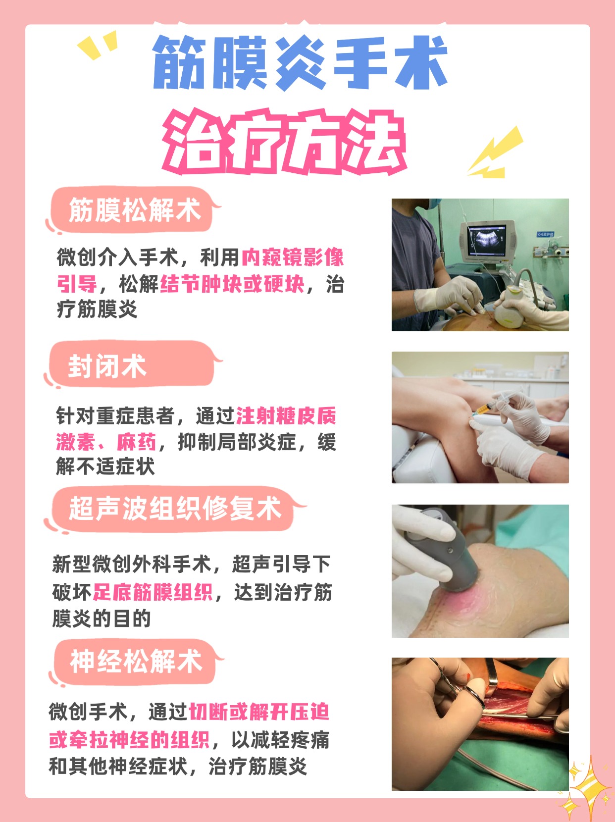 如何治疗筋膜炎