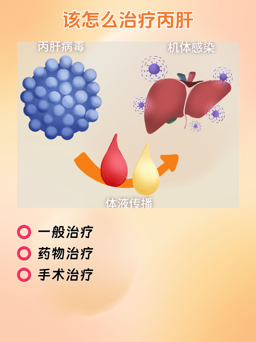 丙肝抗体是什么意思
