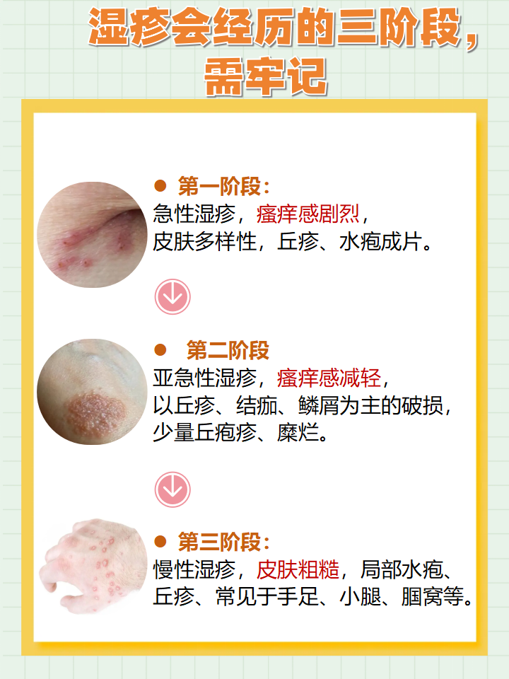什么是湿疹