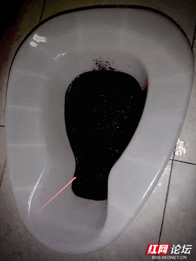 大便黑色是什么