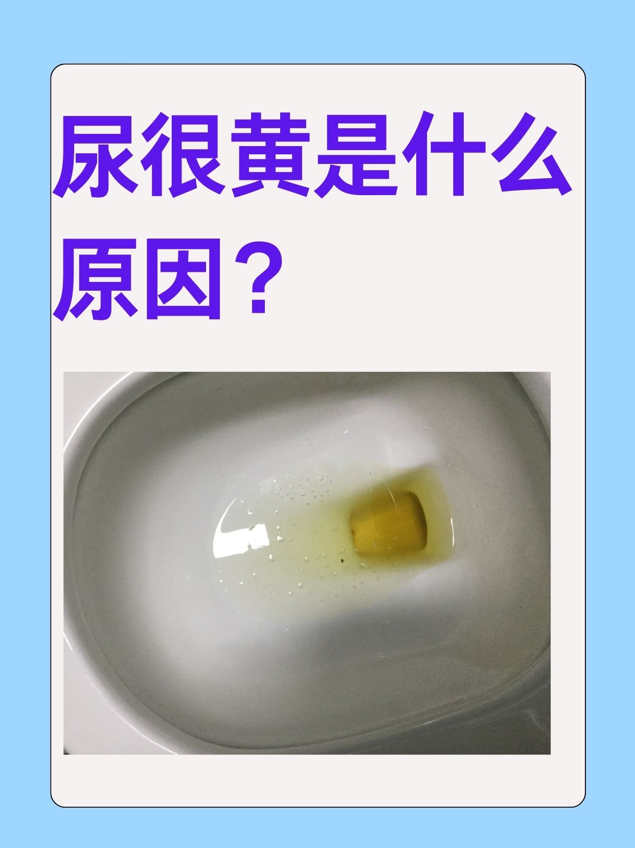 糖尿病的尿是什么症状