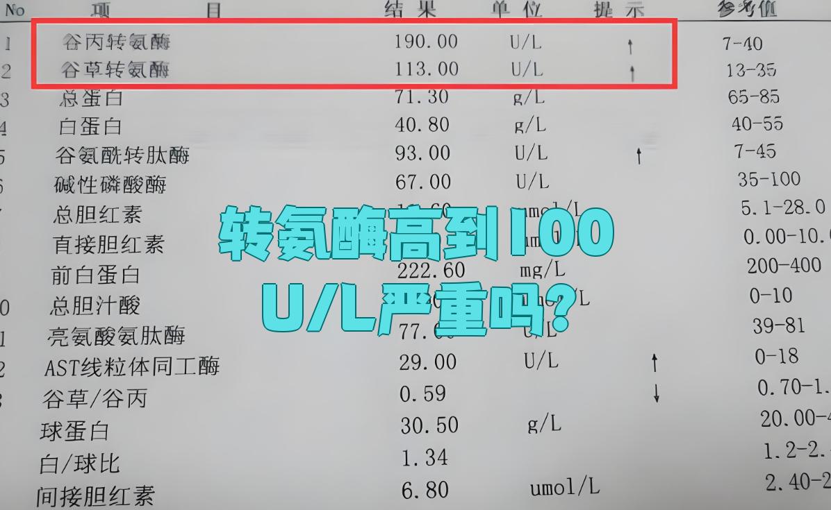 血清丙氨酸氨基转移酶值偏高是什么意思?