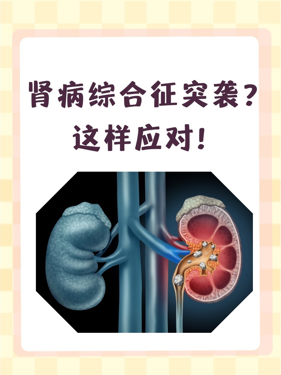 肾病的早期症状有哪些?