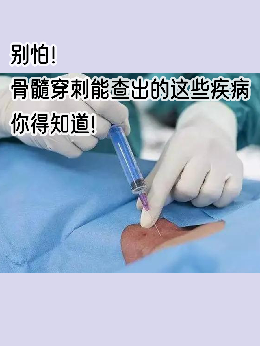 骨髓穿刺术是什么意思