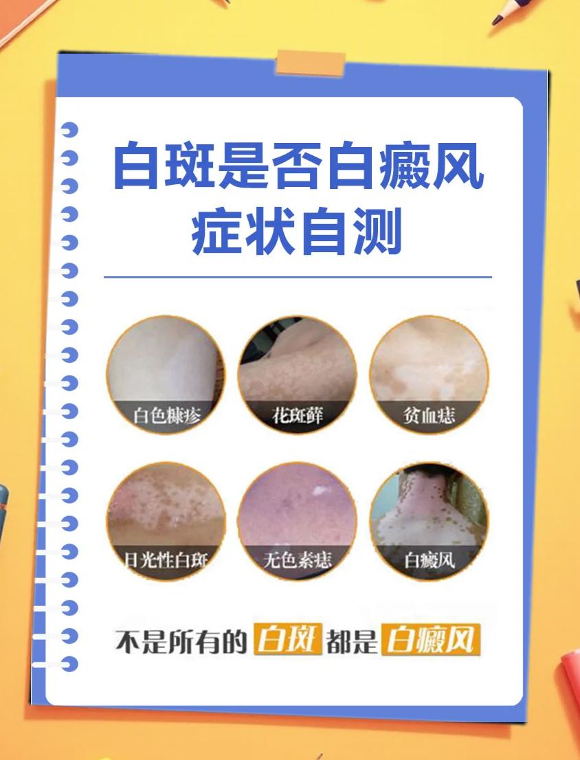 白斑与白癜风的区别