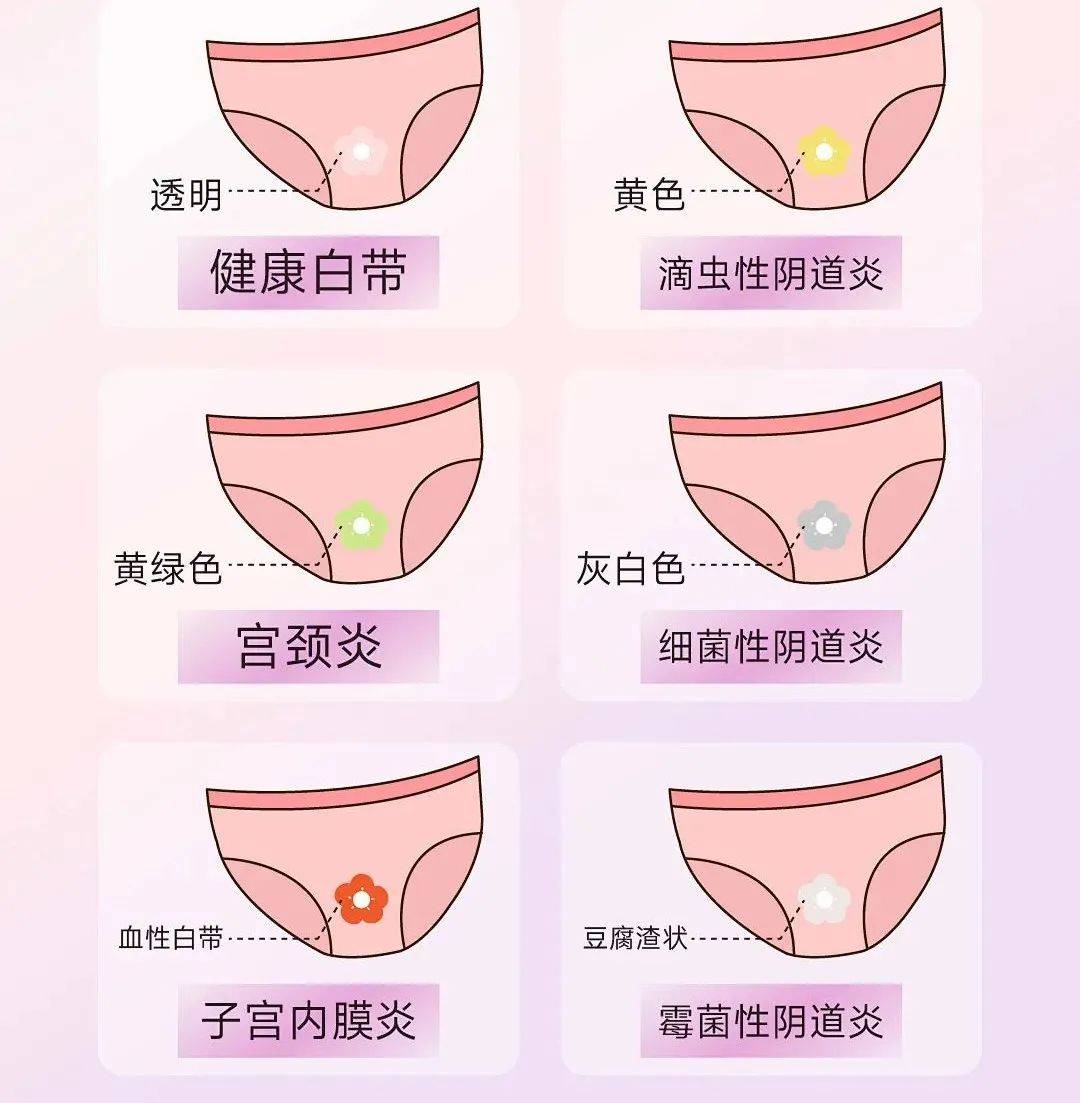 刚怀孕有褐色分泌物正常吗