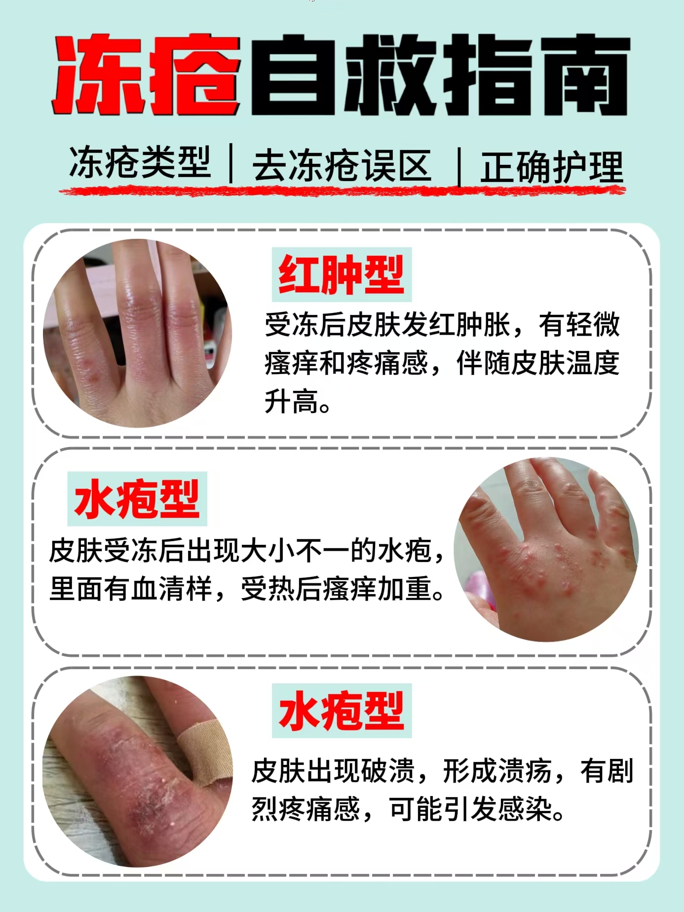 冬天身上痒怎么办
