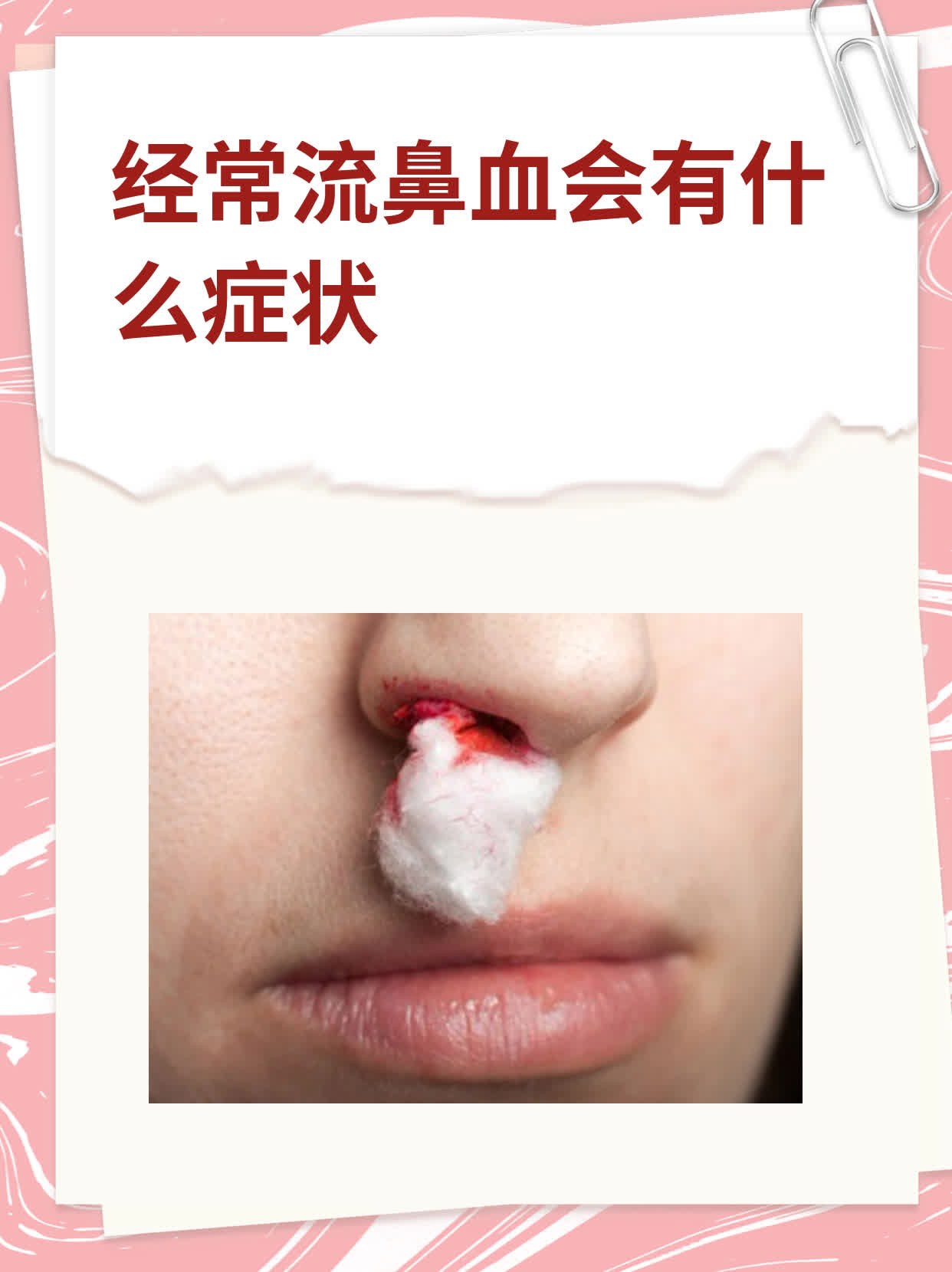 为什么最近经常流鼻血